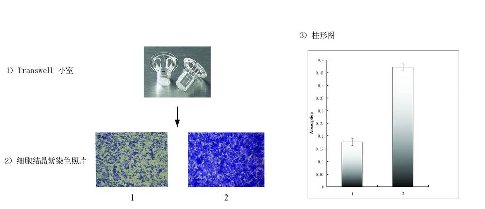 transwell细胞迁移实验结晶紫染色结果及柱形图分析
